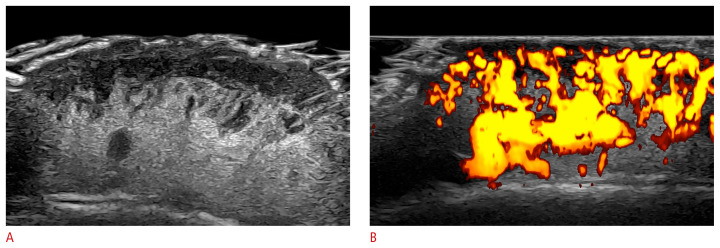 Fig. 10