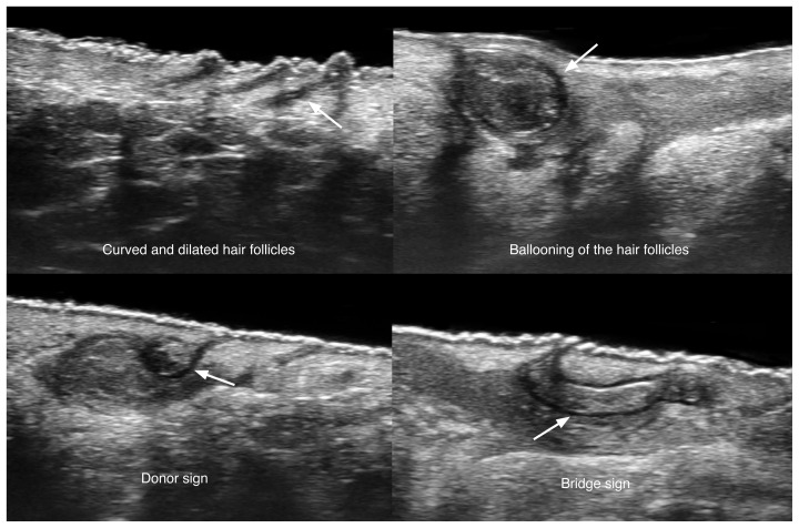 Fig. 12