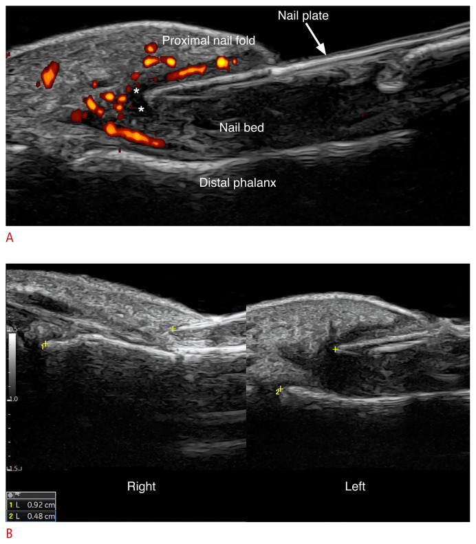 Fig. 21