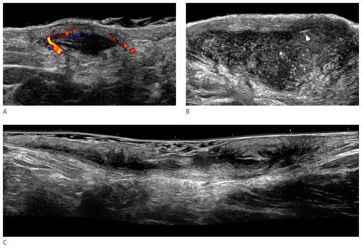 Fig. 13