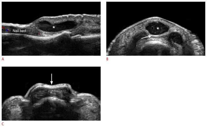 Fig. 19