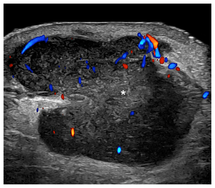 Fig. 9