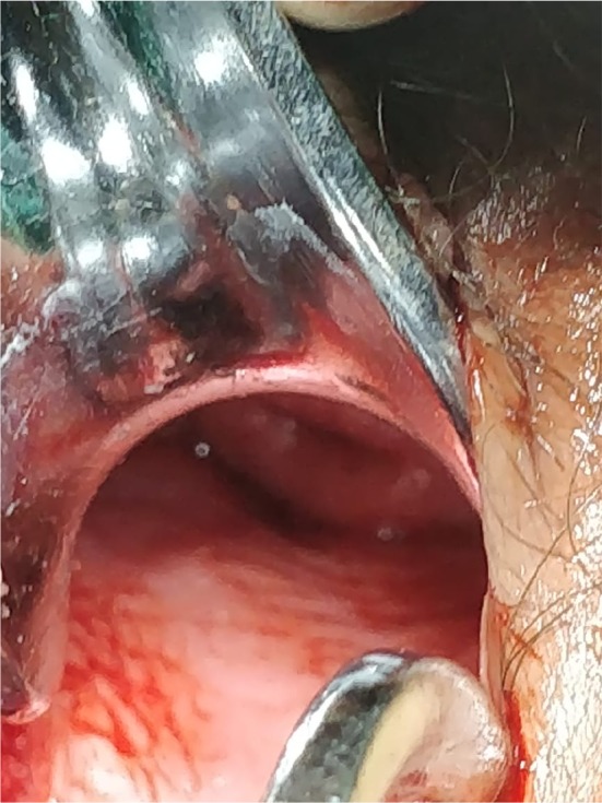 Fig. 3
