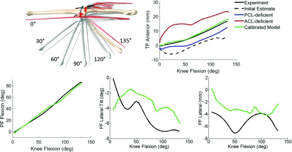 Comparison of model and experimental TF and PF kinematics for the knee extension activity: experiment (-), initial estimate of soft tissue properties from Ref. [17] (--), ACL-deficient, PCL-deficient, and calibrated model predictions