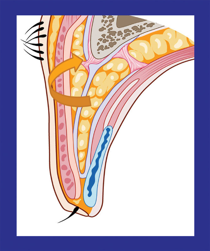 Fig. 17