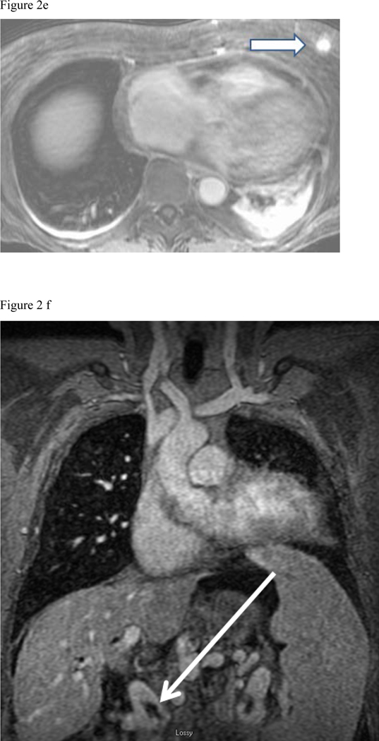 Fig. 2: