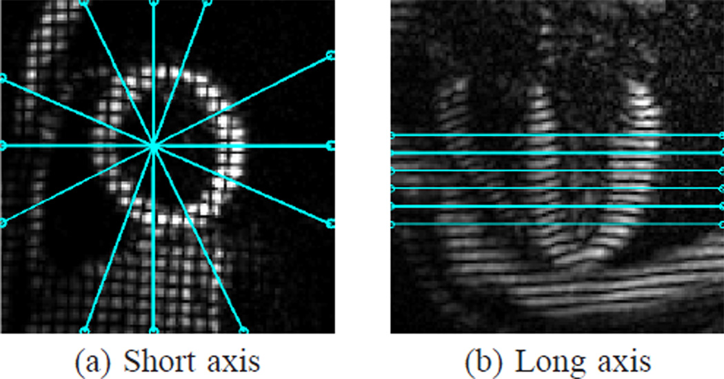 Fig. 12