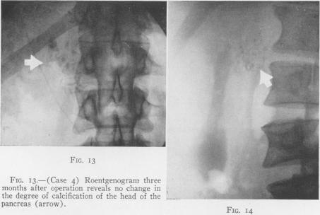 Fig. 13., Fig. 14.