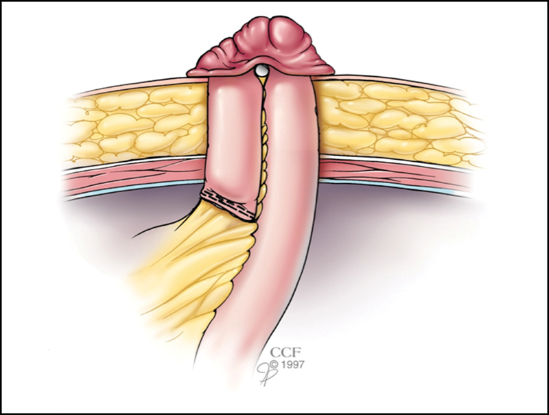 Fig. 5