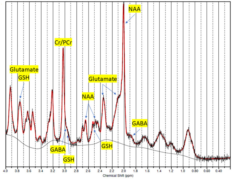 FIGURE 2