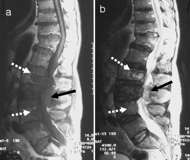 Fig. 20