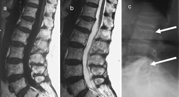 Fig. 12