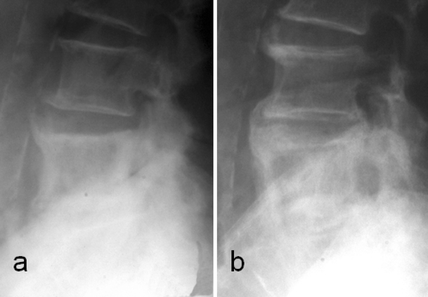 Fig. 18