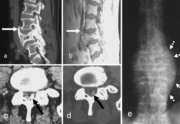 Fig. 19