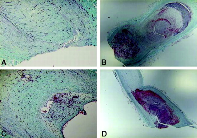 Fig 4.