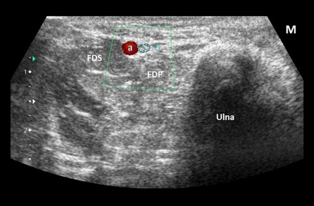 Figure 10