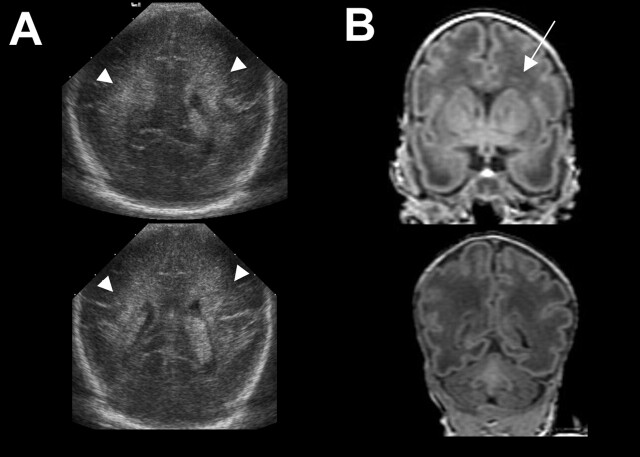 Fig 1.