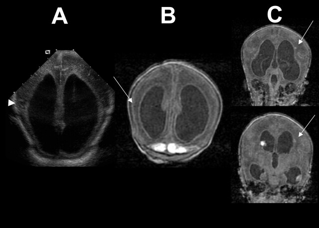 Fig 2.