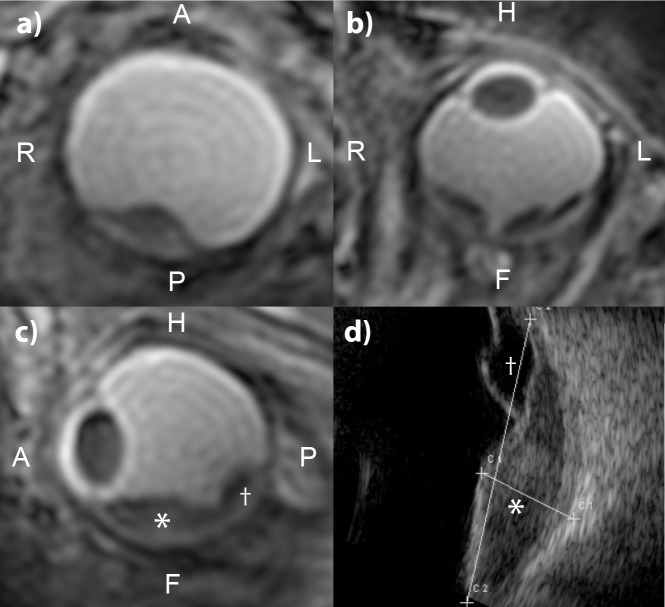 Fig 5