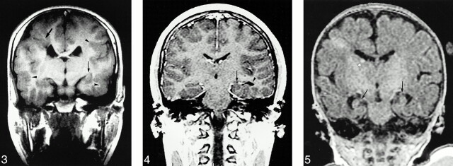 fig 3.