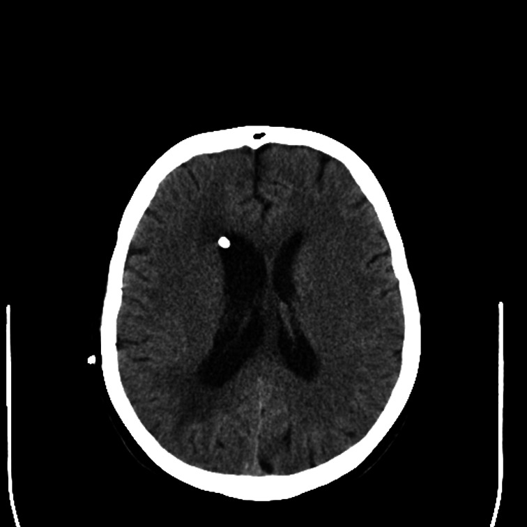 Fig. 7