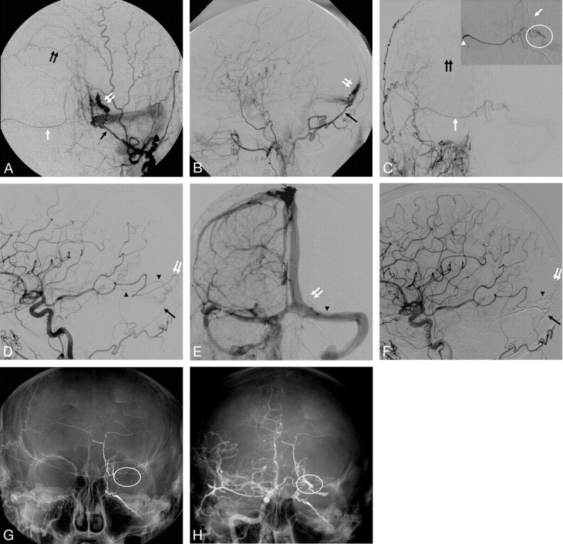 Fig 2.