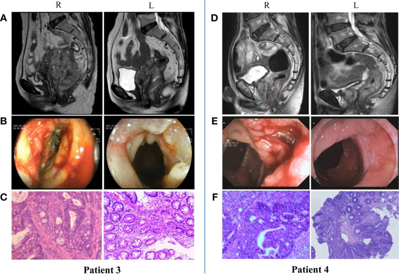 Figure 3