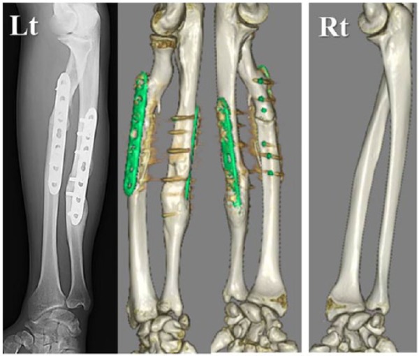 Figure 2.