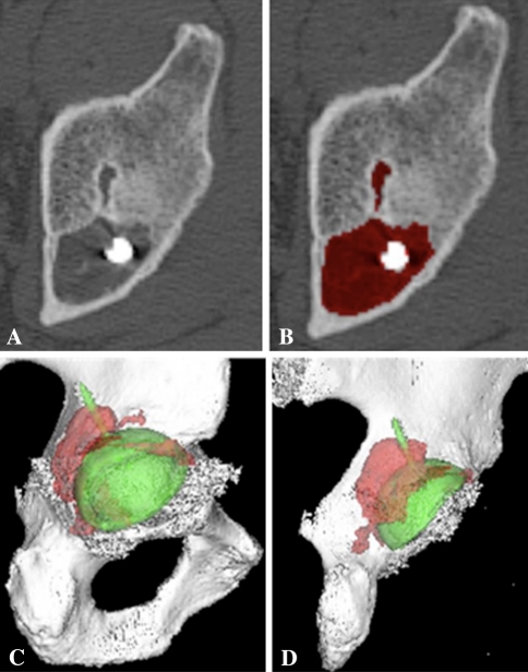 Fig. 4A–D