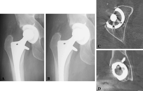 Fig. 5A–D