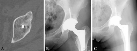 Fig. 2A–C