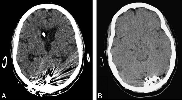 Fig 3.