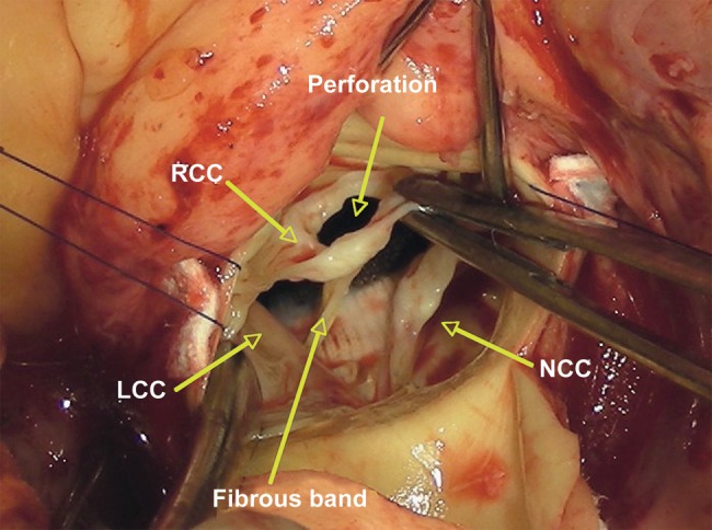 Figure 2: