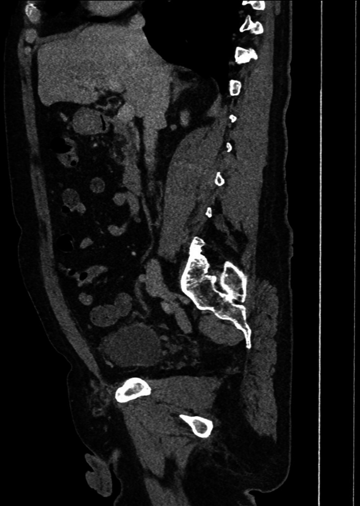 Figure 13.