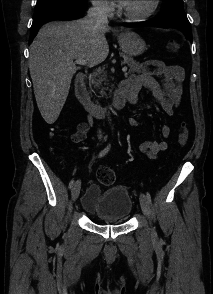 Figure 12.