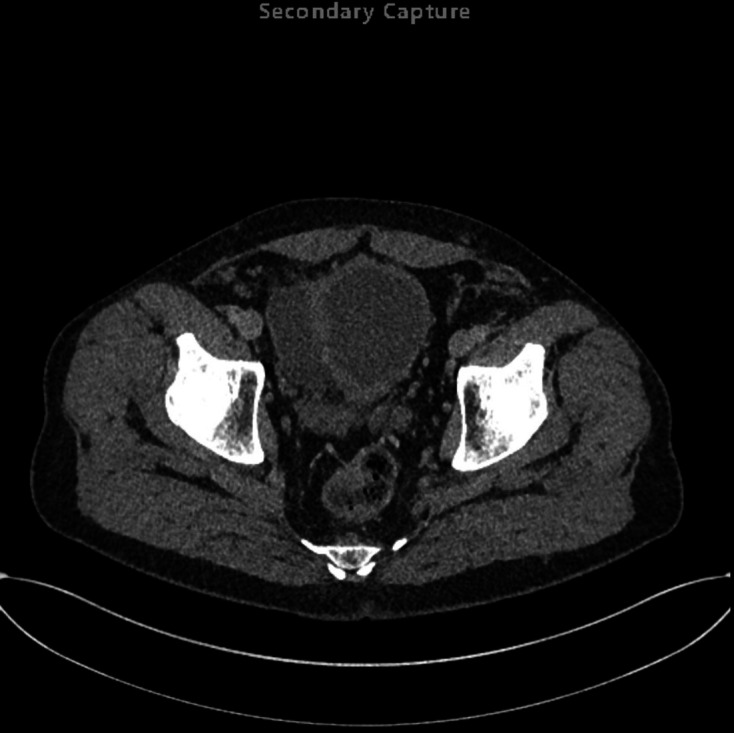 Figure 11.