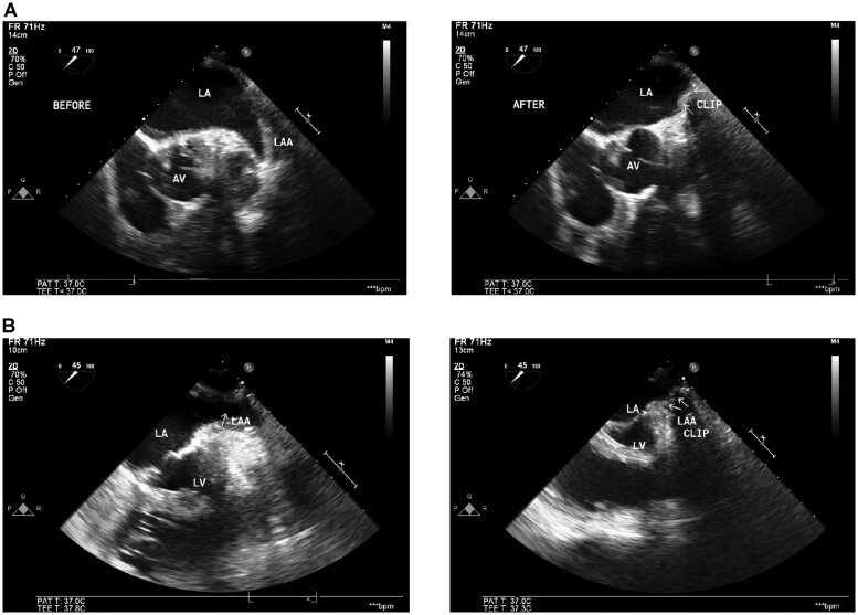 Figure 4: