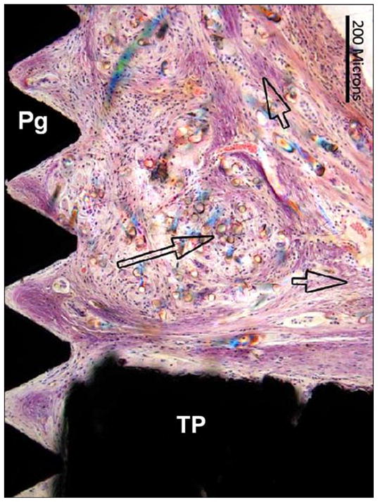 Figure 16