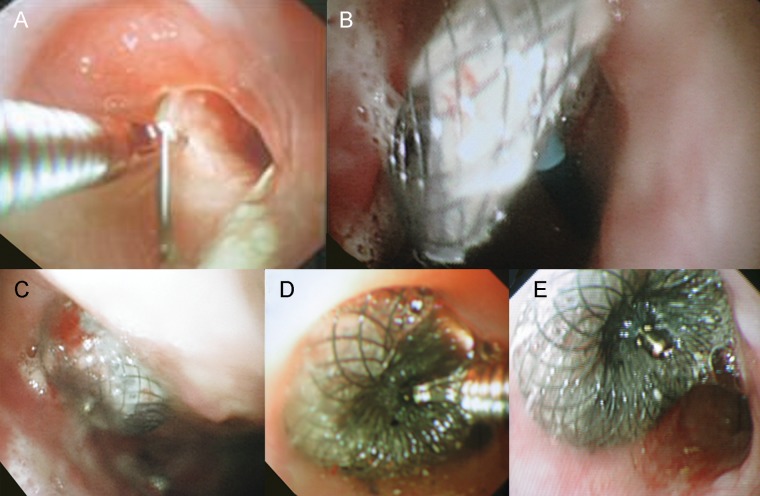 Figure 2: