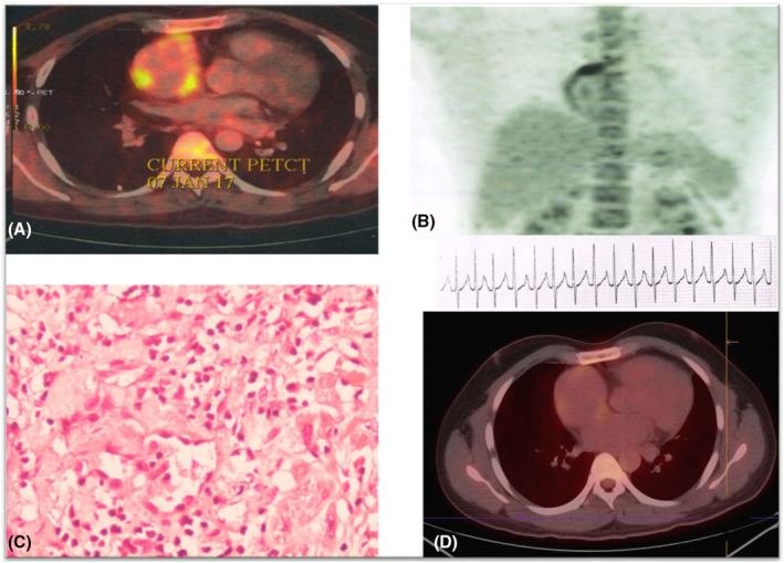 FIGURE 2