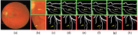 Fig. 13.