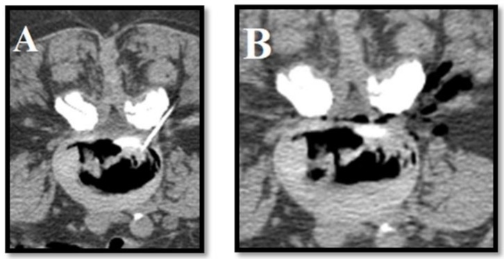 Figure 5