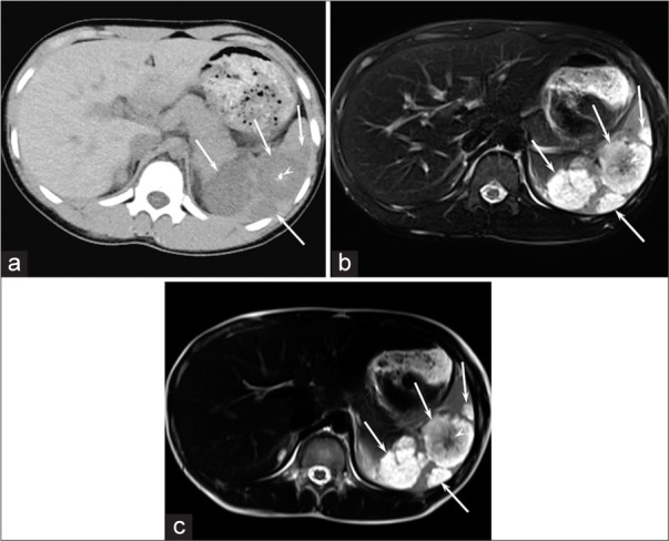 Figure 1: