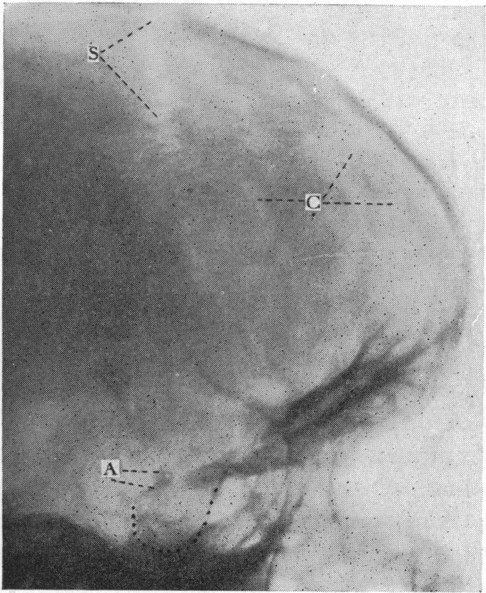 FIG. 10.