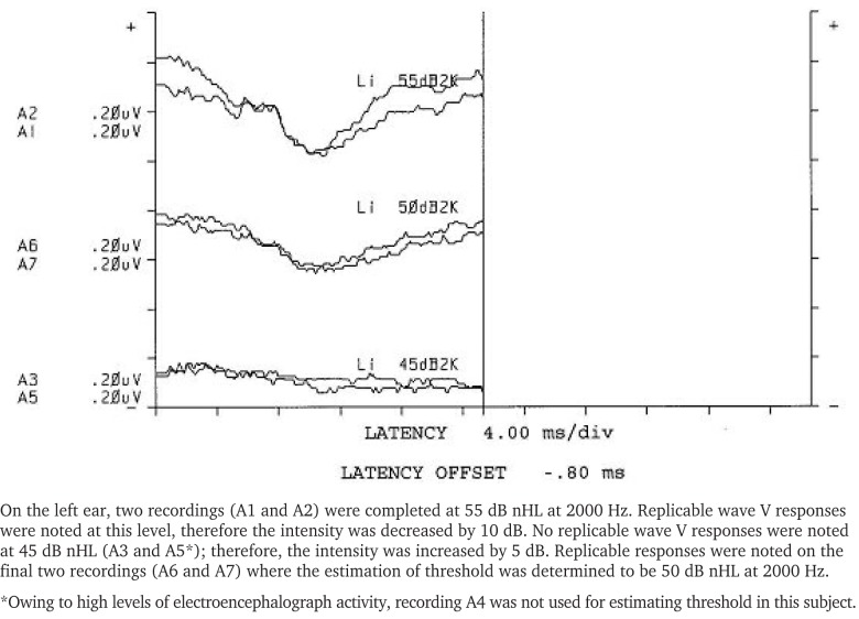 graphic file with name 10.1177_108471380500900404-fig11.jpg