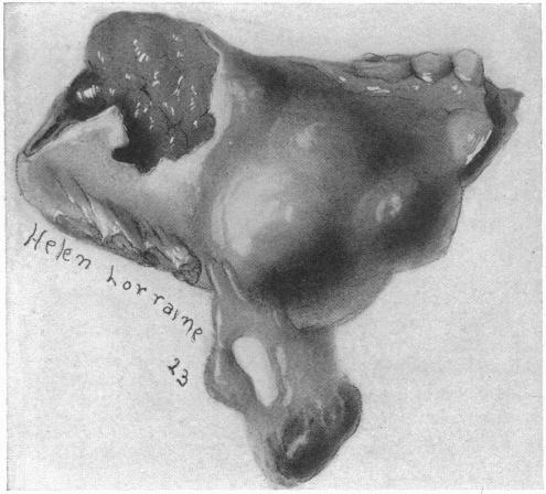 FIG. 5.