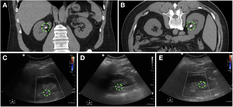 FIGURE 1