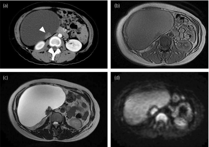 Fig. 1