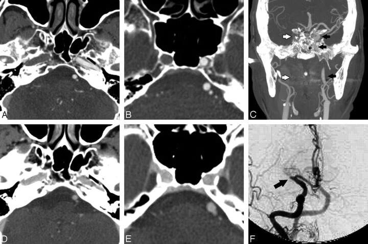 Fig 5.