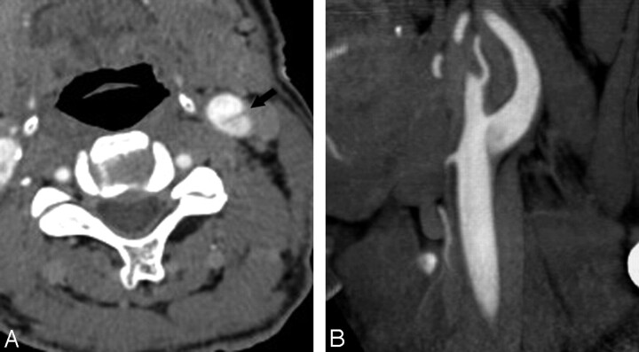 Fig 3.